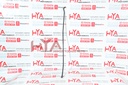 SUPPORT ASSY, HOOD, RH